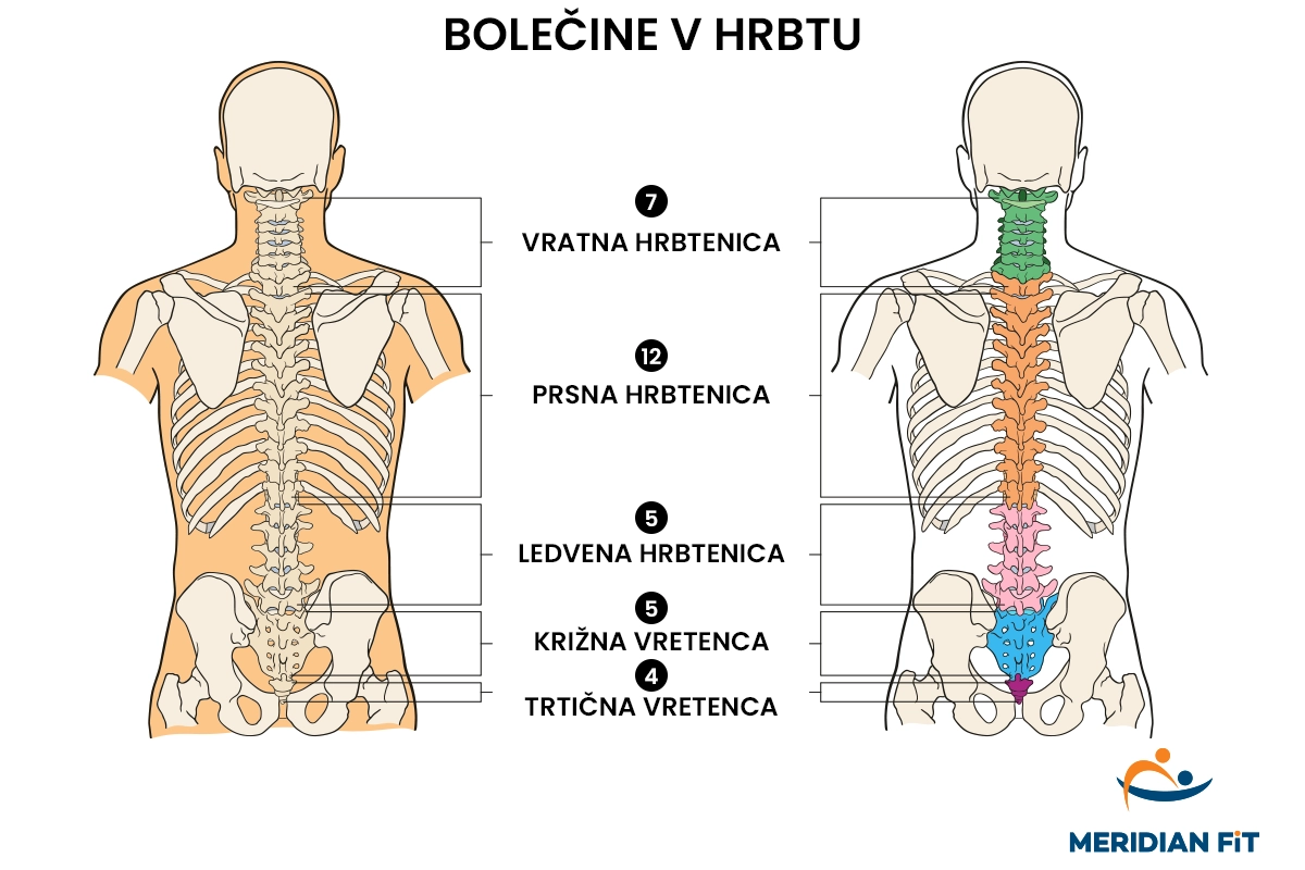 bolečine-v-hrbtu